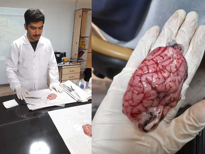 تشریح مغز